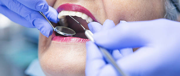 Best Emergency Treatment for Dental Infections or Abscesses in Carrollton, KY